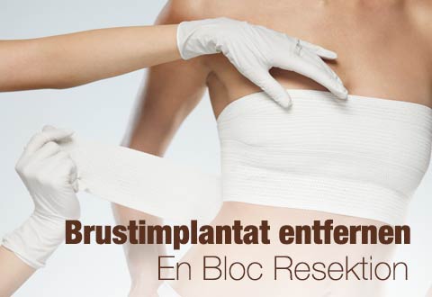 da-schau-her.de unsere Empfehlungen zum Thema ... Brustimplantate entfernen En Bloc Resektion in Bremen Brust OP