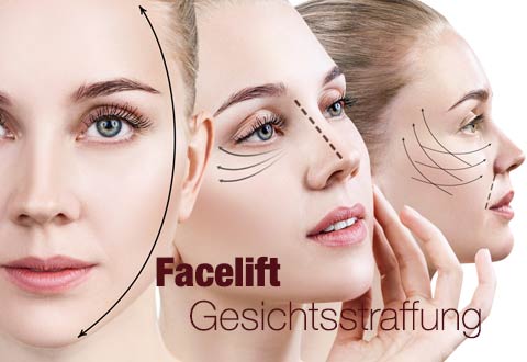 da-schau-her.de unsere Empfehlungen zum Thema ... Facelift Facelifting in Krefeld Schönheits OP