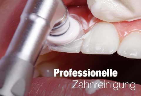 da-schau-her.de unsere Empfehlungen zum Thema ... Zahnreinigung  in Offenburg 