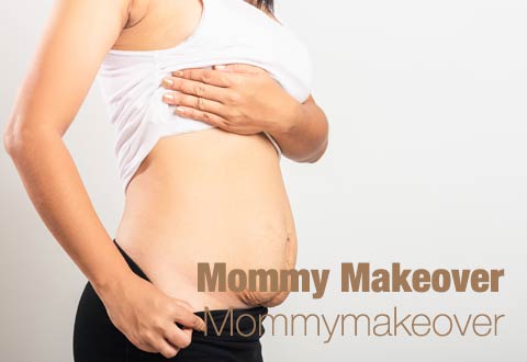 da-schau-her.de präsentiert Empfehlungen zum Thema ... Mommy Makeover Mommymakeover in Düsseldorf 